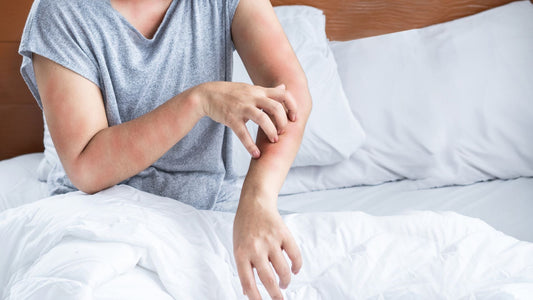 Frau mit allergischem Hautausschlag durch Hausstaubmilben-Allergie – sie kratzt sich am Arm vor Juckreiz