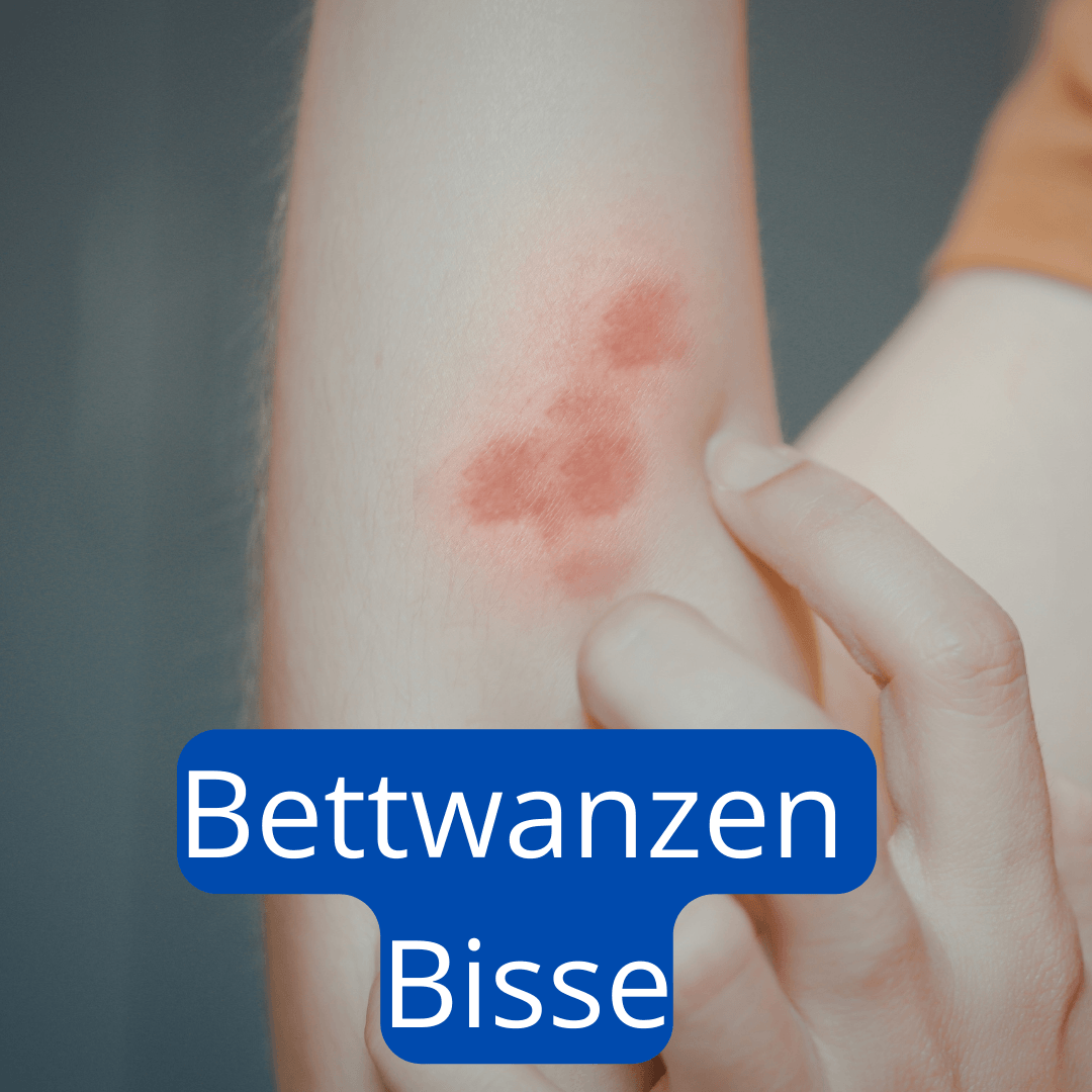 Bettwanzen Bisse auf dem Unterarme