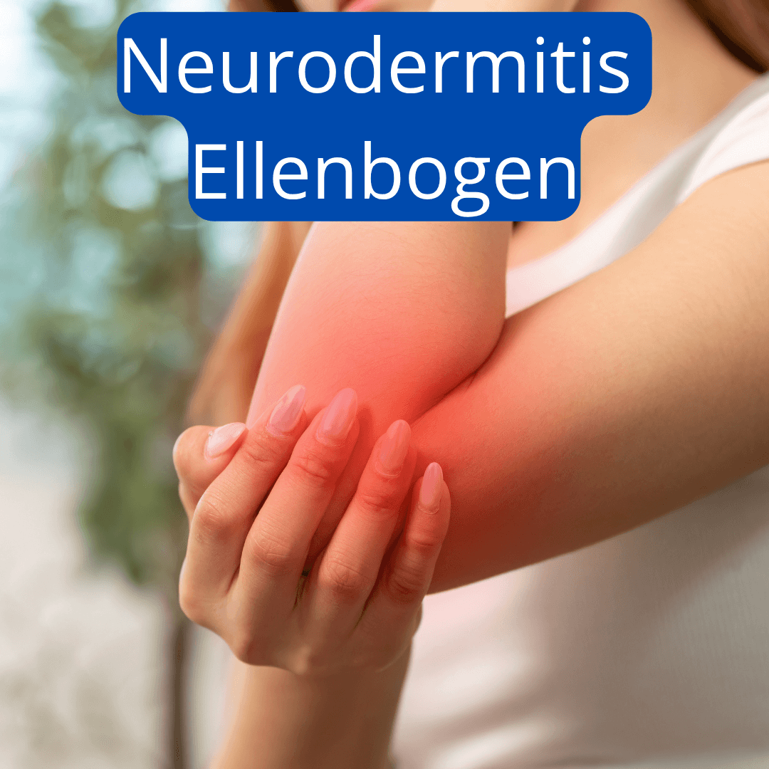 Neurodermitis Ellenbogen